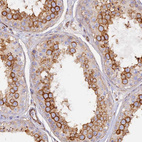 Immunohistochemical staining of human testis shows strong cytoplasmic positivity in cells in seminiferous ducts.
