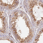 Immunohistochemical staining of human testis shows strong cytoplasmic positivity in cells in seminiferous ducts.