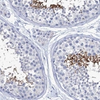 Immunohistochemical staining of human testis shows high expression.