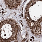 Anti-ANKRD12 Antibody