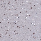 Anti-GAREM1 Antibody