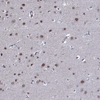 Anti-GAREM1 Antibody