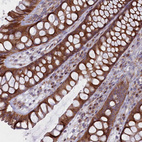 Anti-MTFMT Antibody