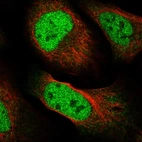 Immunofluorescent staining of human cell line U-2 OS shows localization to nucleoplasm & cytosol.