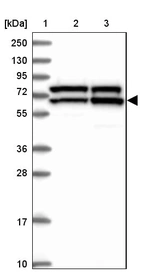 Lane 1: Marker [kDa] 250, 130, 95, 72, 55, 36, 28, 17, 10_br/_Lane 2: Human cell line RT-4_br/_Lane 3: Human cell line U-251MG sp