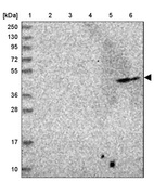Lane 1: Marker [kDa] 250, 130, 95, 72, 55, 36, 28, 17, 10_br/_Lane 2: Human cell line RT-4_br/_Lane 3: Human cell line U-251MG sp_br/_Lane 4: Human plasma (IgG/HSA depleted)_br/_Lane 5: Human liver tissue_br/_Lane 6: Human tonsil tissue