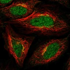 Immunofluorescent staining of human cell line SiHa shows localization to nucleoplasm & the Golgi apparatus.