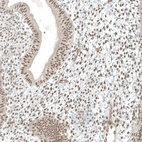Anti-MED20 Antibody