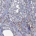 Immunohistochemical staining of human testis shows strong nuclear positivity in Leydig cells and cells in seminiferous ducts.