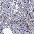 Immunohistochemical staining of human testis shows strong nuclear positivity in Leydig cells and cells in seminiferous ducts.