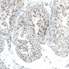 Immunohistochemical staining of human testis shows moderate nuclear positivity in cells in seminiferous ducts.
