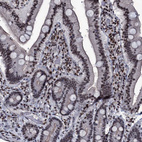 Immunohistochemical staining of human duodenum shows strong nuclear positivity in glandular cells.