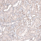 Immunohistochemical staining of human kidney shows moderate nuclear positivity in cells in tubules.