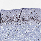 Immunohistochemical staining of human cervix shows strong nuclear positivity in squamous epithelial cells.