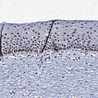 Immunohistochemical staining of human cervix shows strong nuclear positivity in squamous epithelial cells.