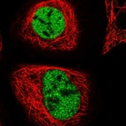 Immunofluorescent staining of human cell line A-431 shows localization to nucleoplasm.