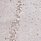 Anti-RP11-382A20.3 Antibody