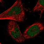 Immunofluorescent staining of human cell line U-251 MG shows localization to nucleoplasm.