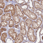 Immunohistochemical staining of human kidney shows moderate cytoplasmic positivity in cells in tubules.