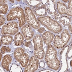 Immunohistochemical staining of human kidney shows moderate cytoplasmic positivity in cells in tubules.