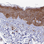 Immunohistochemical staining of human skin shows moderate cytoplasmic positivity in squamous epithelial cells.