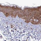 Immunohistochemical staining of human skin shows moderate cytoplasmic positivity in squamous epithelial cells.