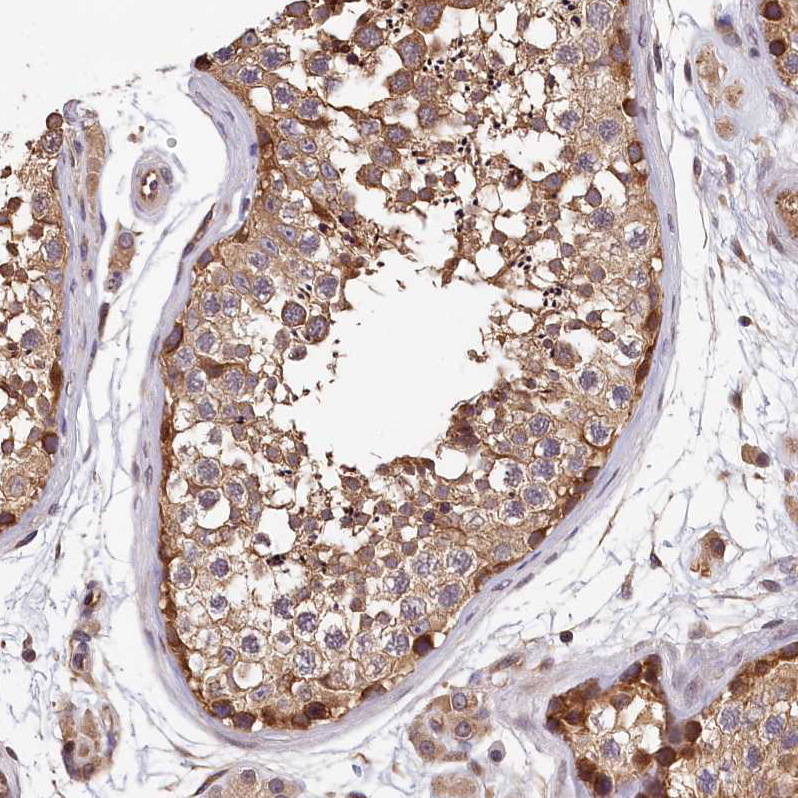 Anti-TMEM116 Antibody