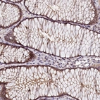 Immunohistochemical staining of human gastrointestinal shows moderate membranous positivity in glandular cells.