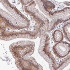 Immunohistochemical staining of human stomach shows moderate membranous positivity in glandular cells.
