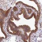 Immunohistochemical staining of human fallopian tube shows strong membranous positivity in glandular cells.