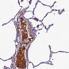 Anti-CFHR1 Antibody