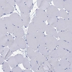 Immunohistochemical staining of human skeletal muscle shows low expression as expected.