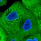 Immunofluorescent staining of human cell line A-431 shows localization to plasma membrane & cytosol.