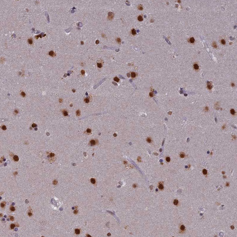 Anti-SPIRE1 Antibody