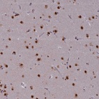 Anti-SPIRE1 Antibody