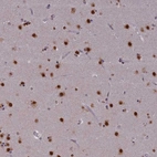 Anti-SPIRE1 Antibody