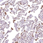 Anti-RASSF1 Antibody