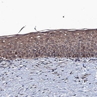 Immunohistochemical staining of human cervix shows moderate granular cytoplasmic positivity in squamous epithelial cells.
