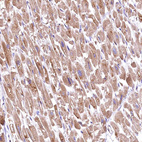 Immunohistochemical staining of human heart muscle shows moderate cytoplasmic positivity in cardiomyocytes.