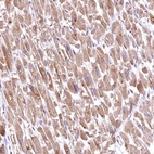 Immunohistochemical staining of human heart muscle shows moderate cytoplasmic positivity in cardiomyocytes.