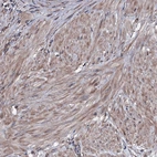 Immunohistochemical staining of human prostate shows moderate cytoplasmic positivity in smooth muscle cells.
