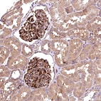 Immunohistochemical staining of human kidney shows strong cytoplasmic positivity in cells in glomeruli.