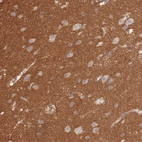 Anti-GNB4 Antibody