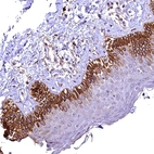 Immunohistochemical staining of human skin shows strong cytoplasmic positivity in subset of squamous epithelial cells.