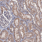 Immunohistochemical staining of human kidney shows moderate granular cytoplasmic positivity in cells in tubules.