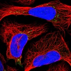 Immunofluorescent staining of human cell line U-2 OS shows localization to vesicles.