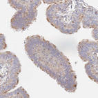 Immunohistochemical staining of human fallopian tube shows strong membranous positivity in glandular cells.