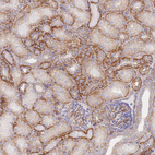 Immunohistochemical staining of human kidney shows strong membranous positivity in cells in tubules.