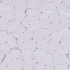 Immunohistochemical staining of human skeletal muscle shows no positivity in myocytes as expected.