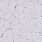 Immunohistochemical staining of human skeletal muscle shows no positivity in myocytes as expected.